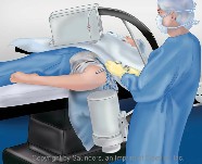 Knee arthoscopy | Arthroscopic knee surgery