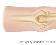 Elbow anatomy