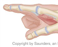 Hand surgery